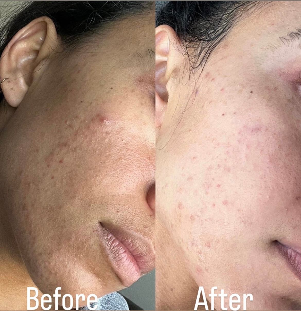Before \ After Enzyme Mask result
