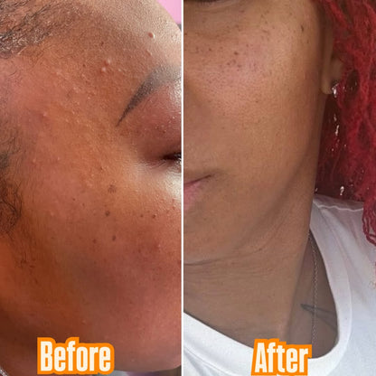 Gentle Glow Evenskin Cleanser