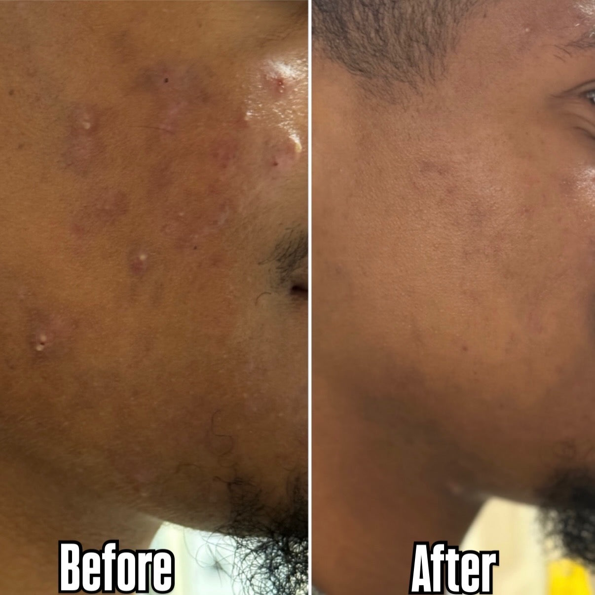 Clarify Blemish Glow Cleanser